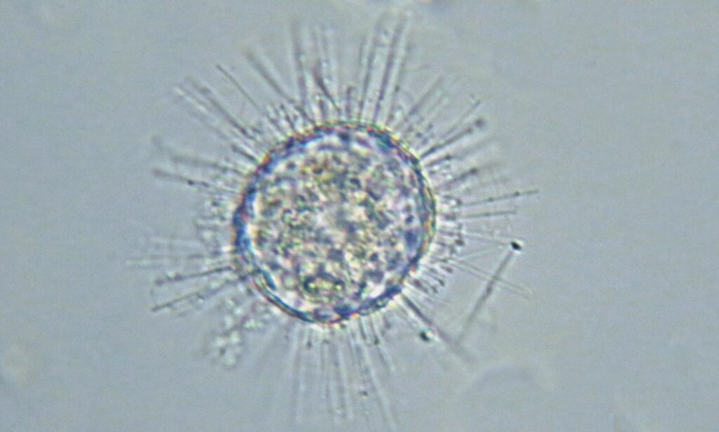 Zooplankton : Acanthocystis sp.