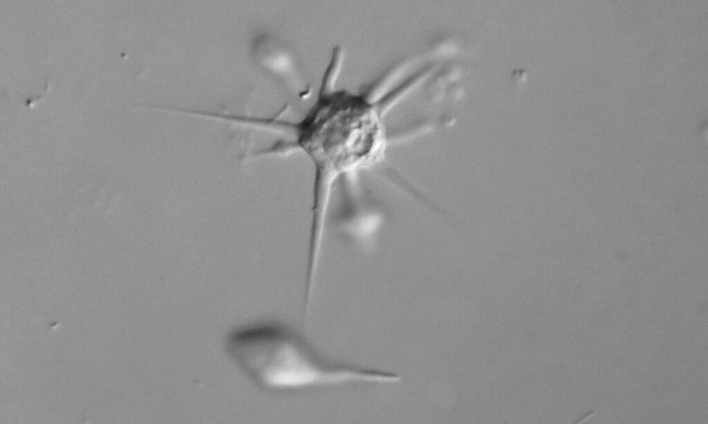 Zooplankton : Astramoeba radiosa