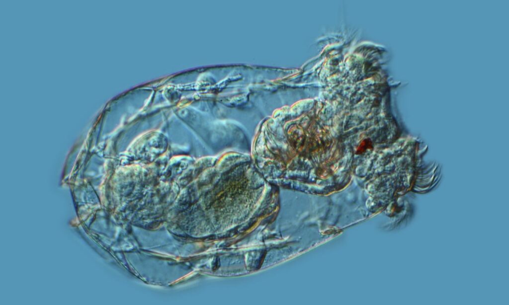 Zooplankton : Brachionus angularis