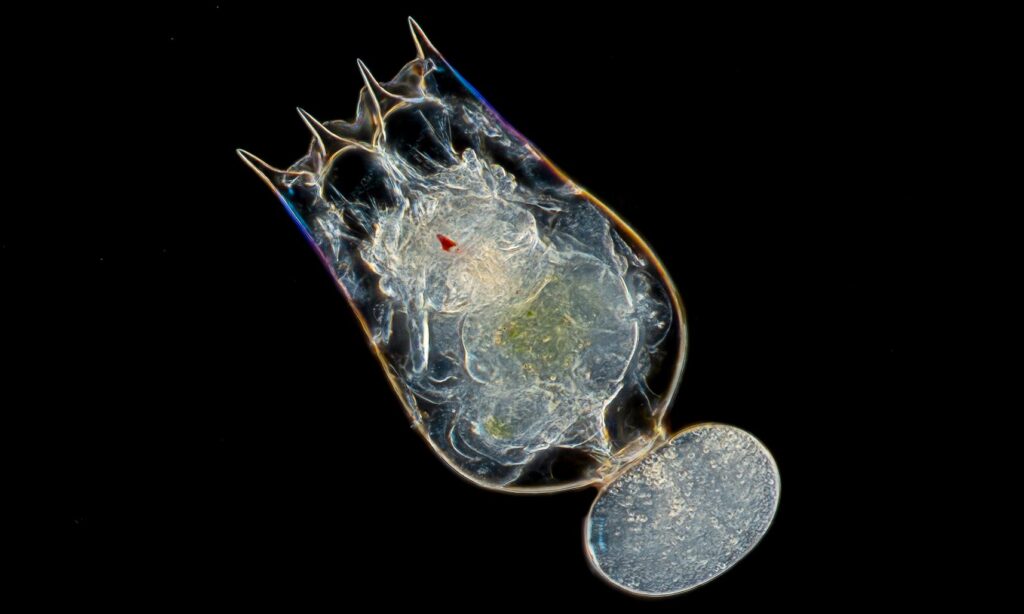 Zooplankton : Brachionus calyciflorus