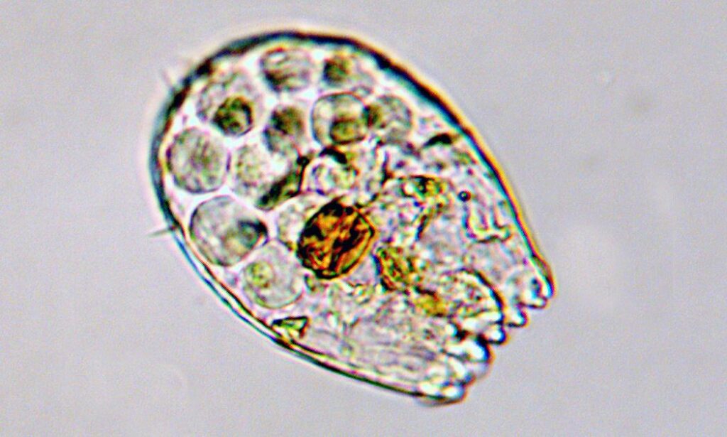 Zooplankton : Euglypha sp.
