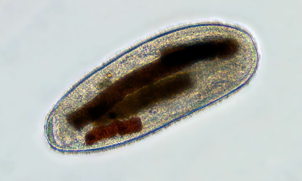 Zooplankton : Frontonia sp.