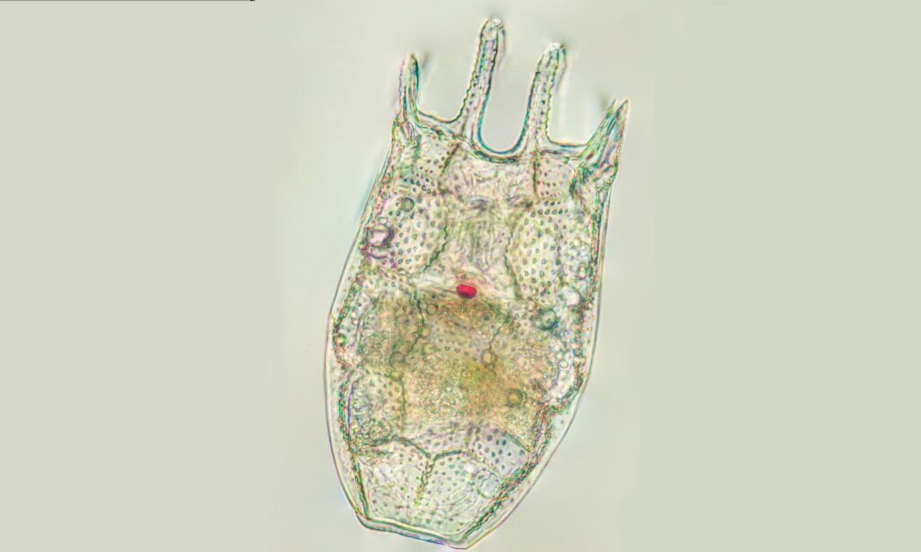 Zooplankton : Keratella stipitata