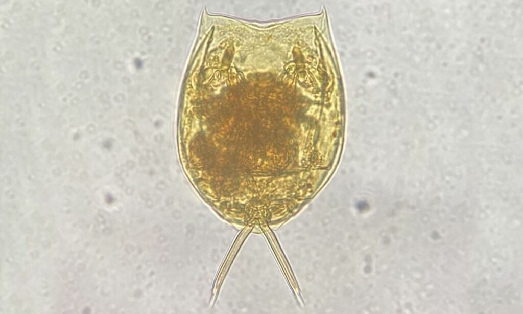 Zooplankton : Lecane curvicornis