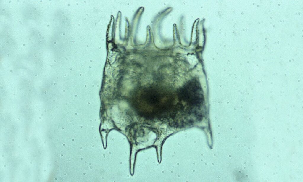 Zooplankton : Plationus patulus