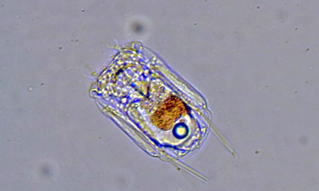 Zooplankton : Polyarthra sp.