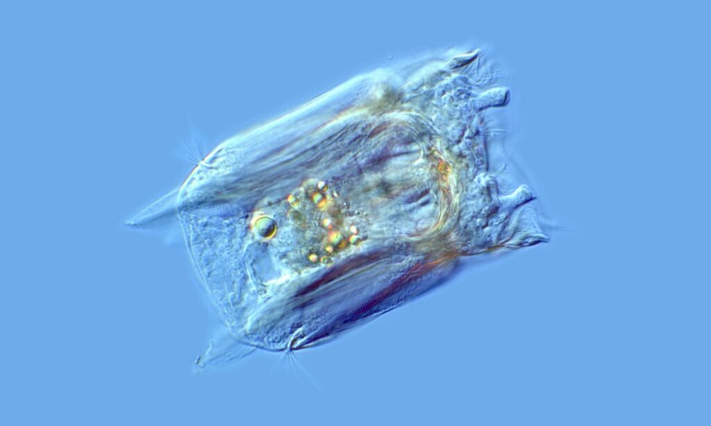 Zooplankton : Polyarthra vulgaris