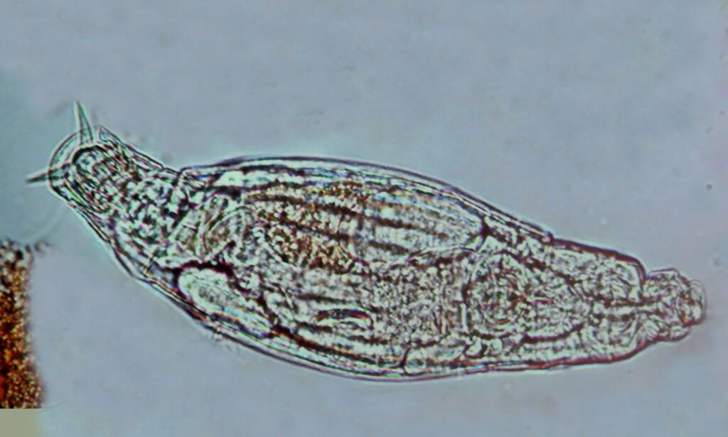 Zooplankton : Rotaria sp.
