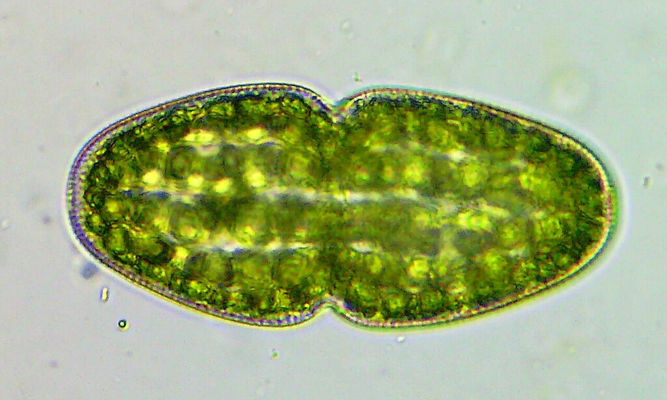 Phytoplankton : Actinotaenium turgidum - -