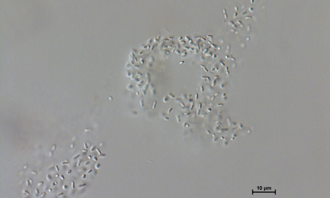 Phytoplankton : Anathece clathrata - -