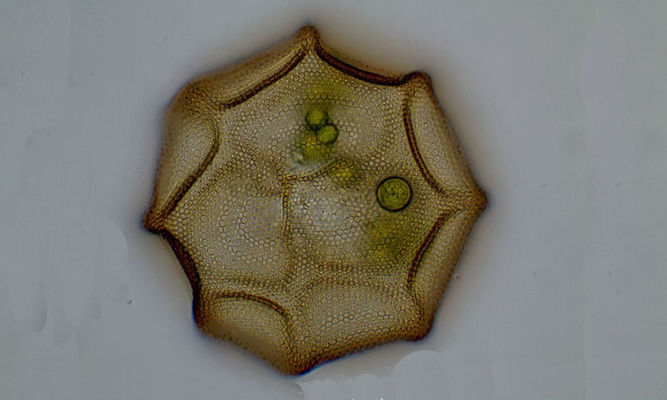 Zooplankton : Arcella sp. - -