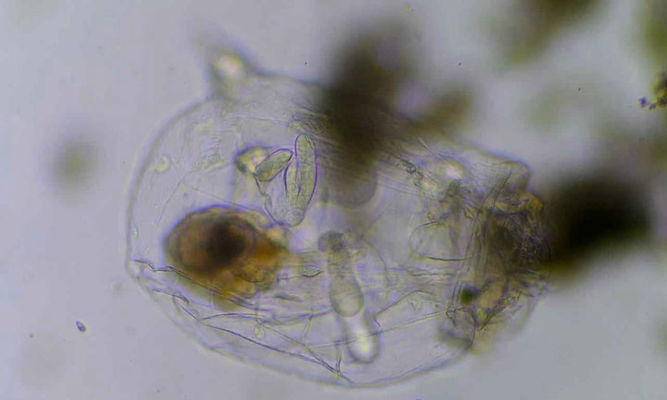 Zooplankton : Asplanchnopus sp. - -
