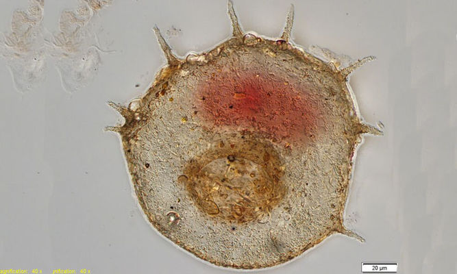 Zooplankton : Centropyxis sp. - -