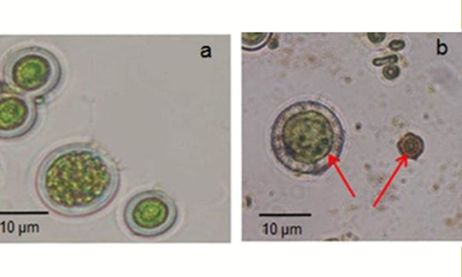 Phytoplankton : Chlorococcum infusionum - -