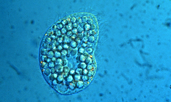 Zooplankton : Colpoda sp. - -