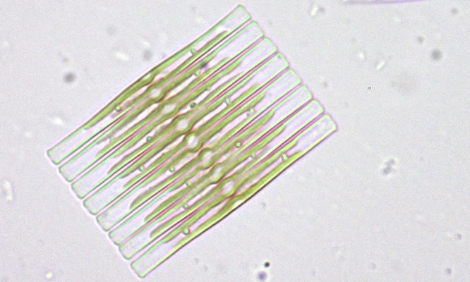 Phytoplankton : Fragilaria crotonensis - -