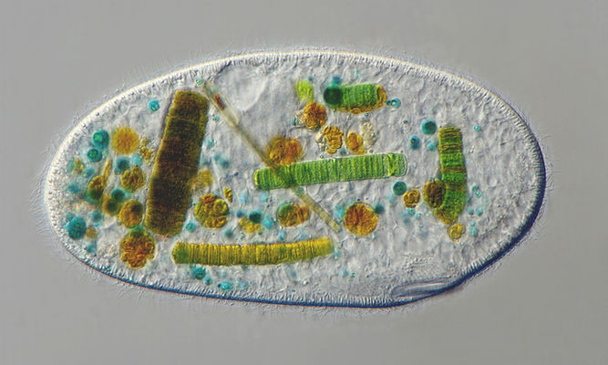 Zooplankton : Frontonia sp. - -