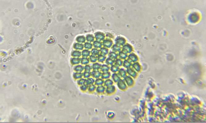 Phytoplankton : Microcrocis granulata - -