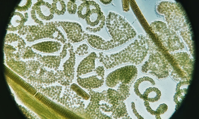 Phytoplankton : Microcystis wesenbergii - -