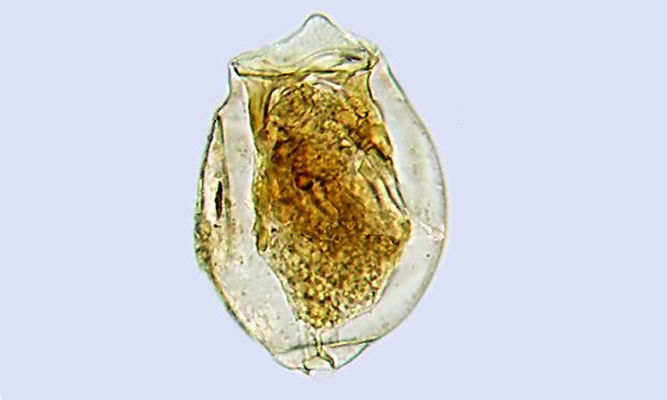 Zooplankton : Pompholyx sulcata - -