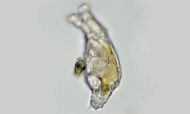 Zooplankton : Rotaria sp. - -