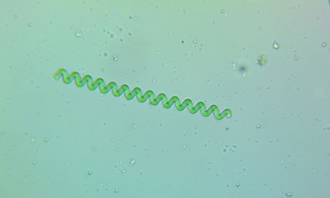 Phytoplankton : Spirulina major - -