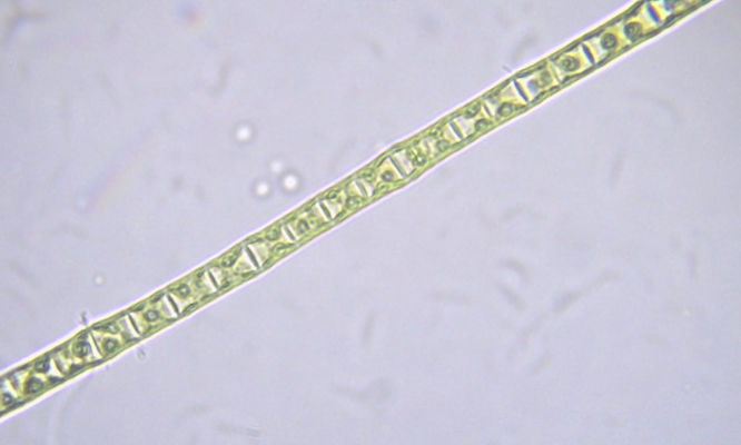 Phytoplankton : Ulothrix sp. - -