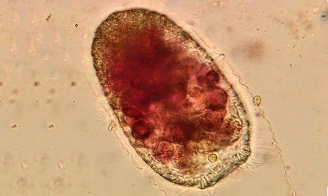 Zooplankton : Vasicola ciliata - -