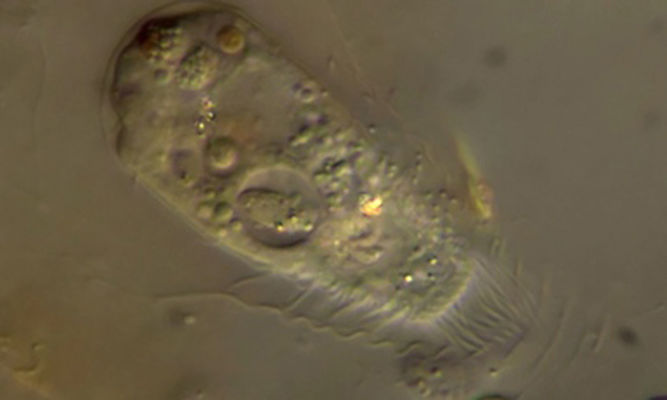 Zooplankton : Vasicola sp. - -